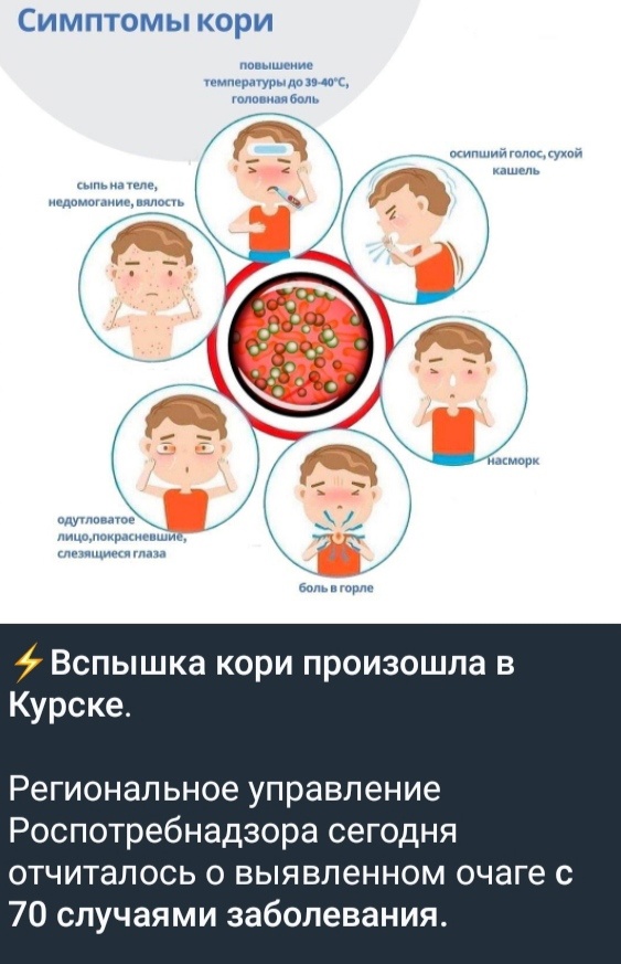 Корь