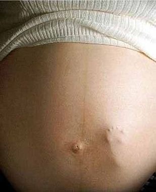 getImage (31)