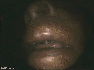 Nose maggots