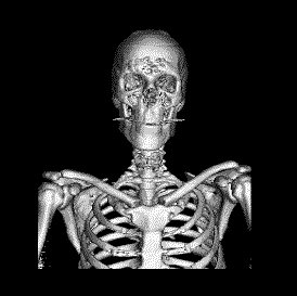Skeleton