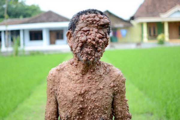 rare skin disease pictures